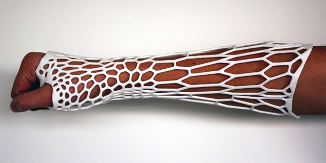 Jake Evill Cortex 3D printed Exoskeletal Cast recyclable breathable light washable